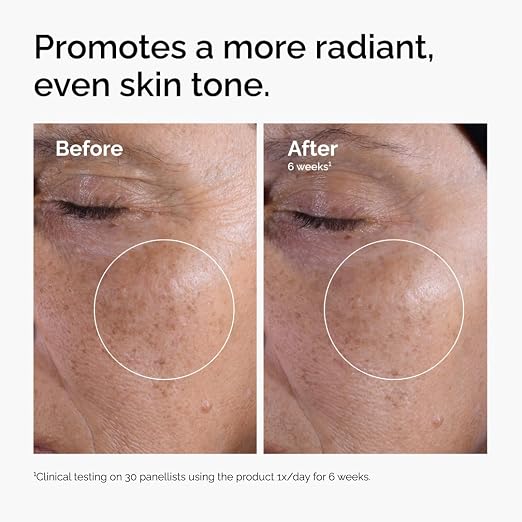 The Ordinary Glycolic Acid 7% Exfoliating Toner – 240ml AHA Facial Toner for Smoother Skin, Brighter Complexion & Even-Looking Skin Tone, Fragrance-Free