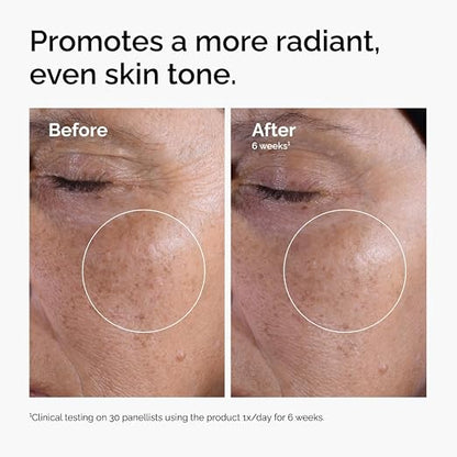 The Ordinary Glycolic Acid 7% Exfoliating Toner – 240ml AHA Facial Toner for Smoother Skin, Brighter Complexion & Even-Looking Skin Tone, Fragrance-Free