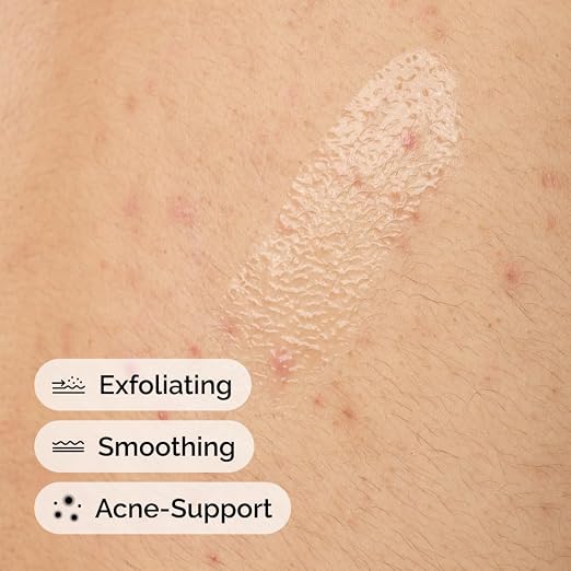 The Ordinary Salicylic Acid 0.5% Body Serum – 240ml Exfoliating Body Acne Treatment for Blemish-Prone Skin, Clogged Pores & Uneven Skin Texture, Fragrance-Free - Home products with | Sold by Uncle Wiener's Wholesale